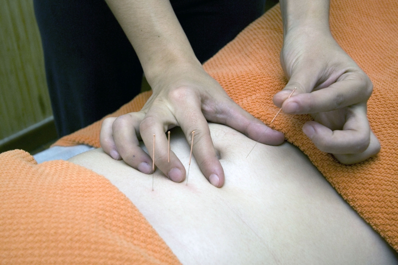 osteopathe-EZE-min_acupuncture-4175625